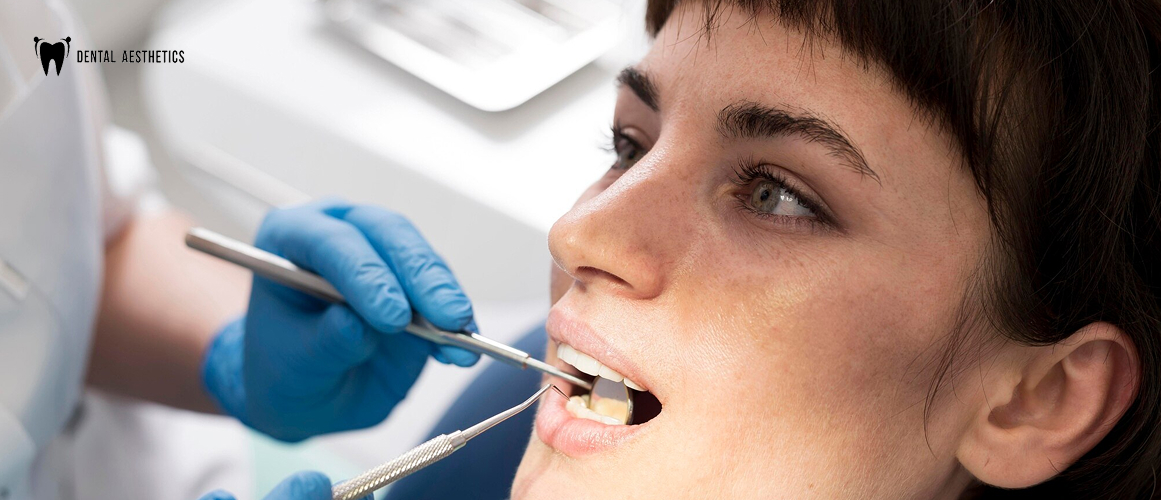 How to Remove Black Stains from Teeth